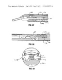 ENDOSCOPIC SURGICAL CLIP APPLIER diagram and image