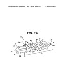 MEDICAL FIXATION DEVICES WITH IMPROVED TORSIONAL DRIVE HEAD diagram and image