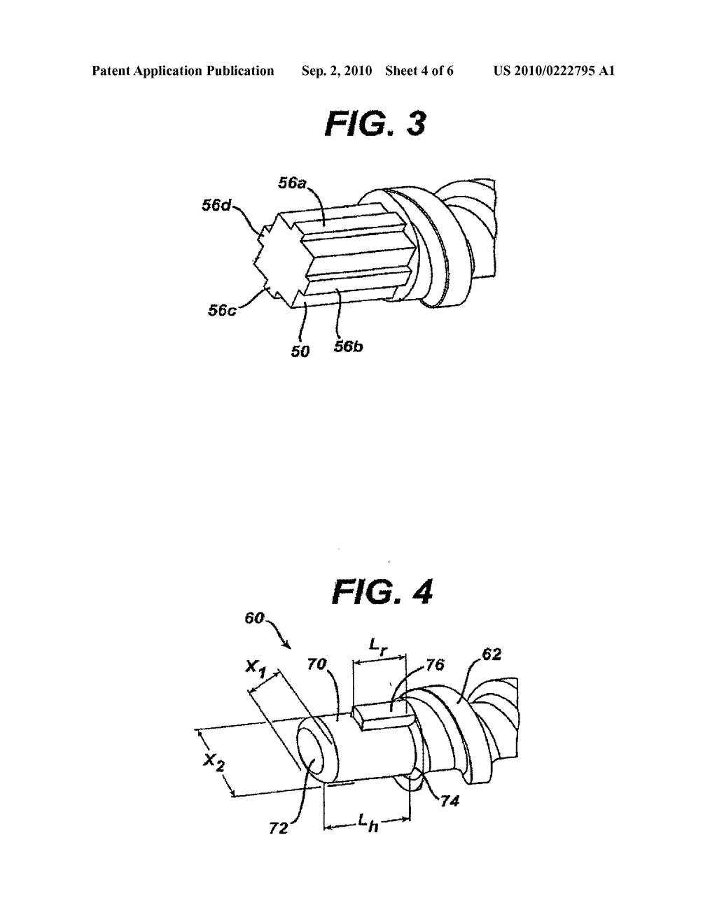 MEDICAL FIXATION DEVICES WITH IMPROVED TORSIONAL DRIVE HEAD - diagram, schematic, and image 05