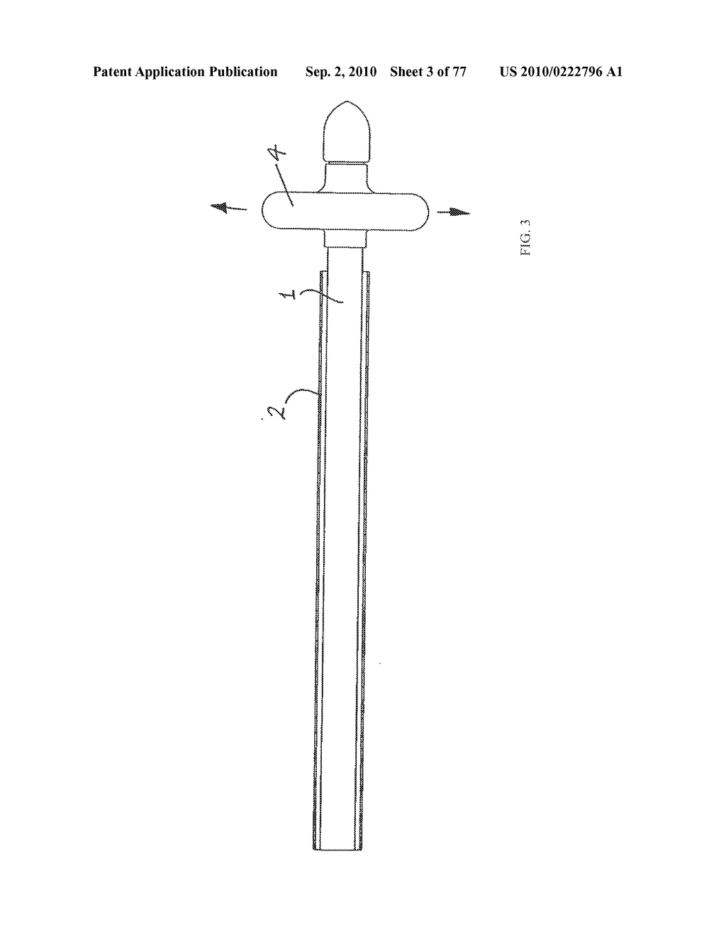 INTERVENTIONAL MEDICAL CLOSURE DEVICE - diagram, schematic, and image 04