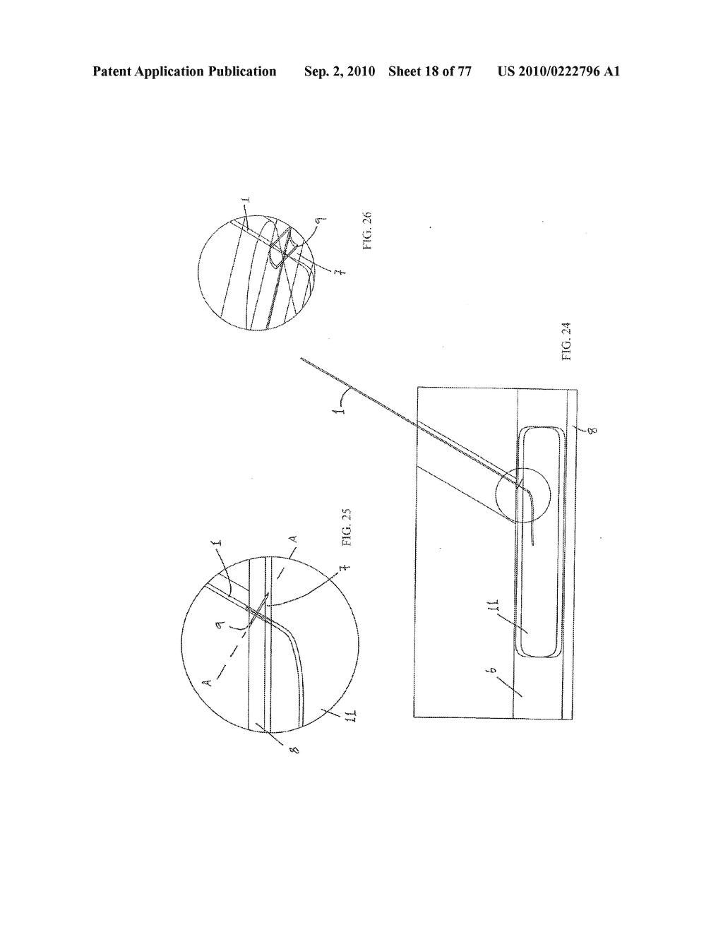 INTERVENTIONAL MEDICAL CLOSURE DEVICE - diagram, schematic, and image 19