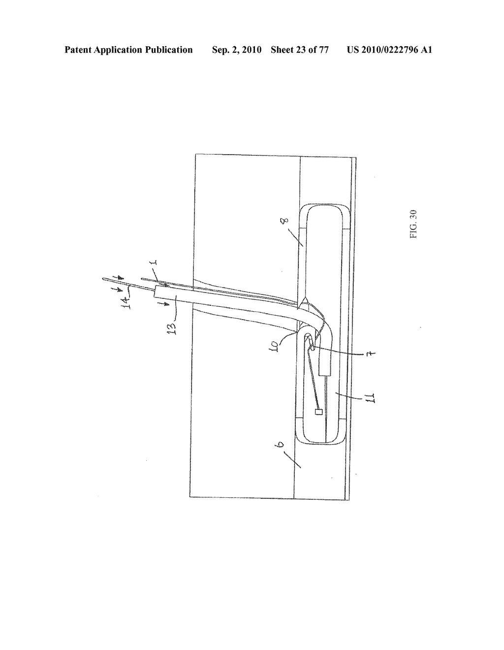 INTERVENTIONAL MEDICAL CLOSURE DEVICE - diagram, schematic, and image 24