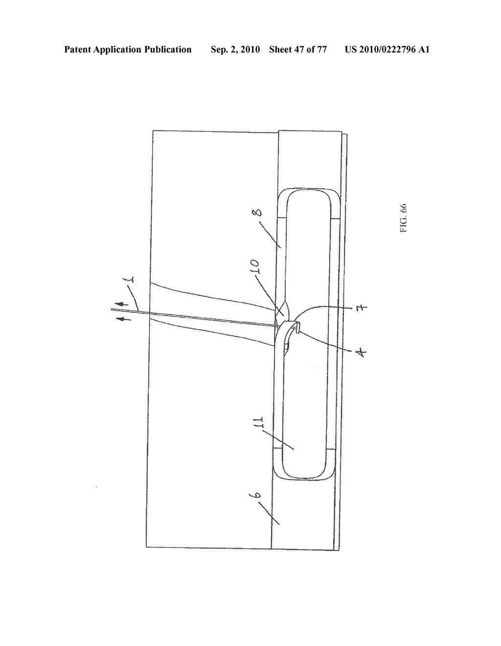 INTERVENTIONAL MEDICAL CLOSURE DEVICE - diagram, schematic, and image 48