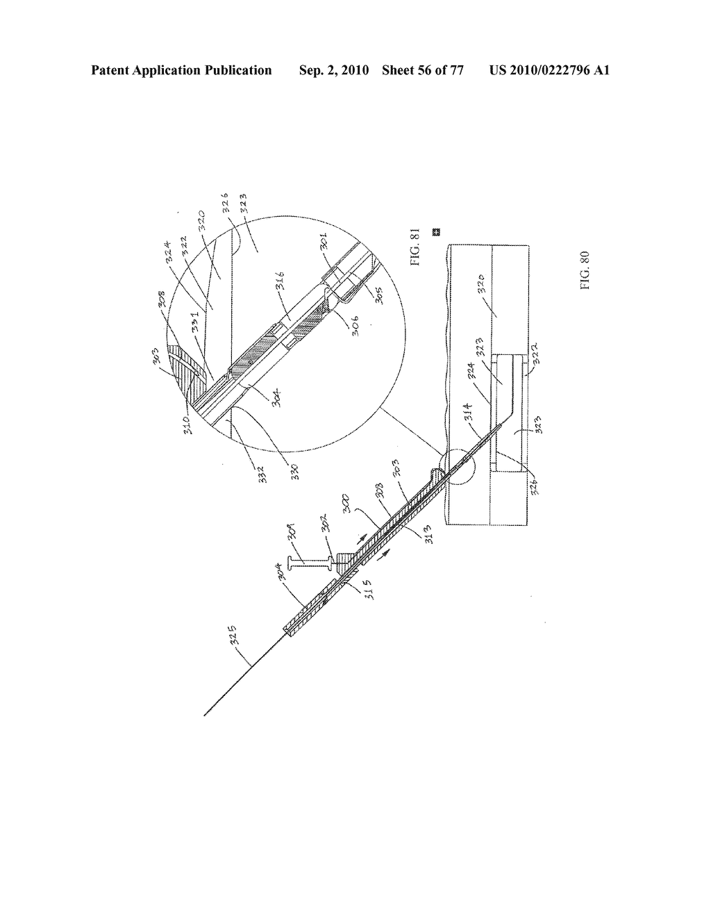 INTERVENTIONAL MEDICAL CLOSURE DEVICE - diagram, schematic, and image 57