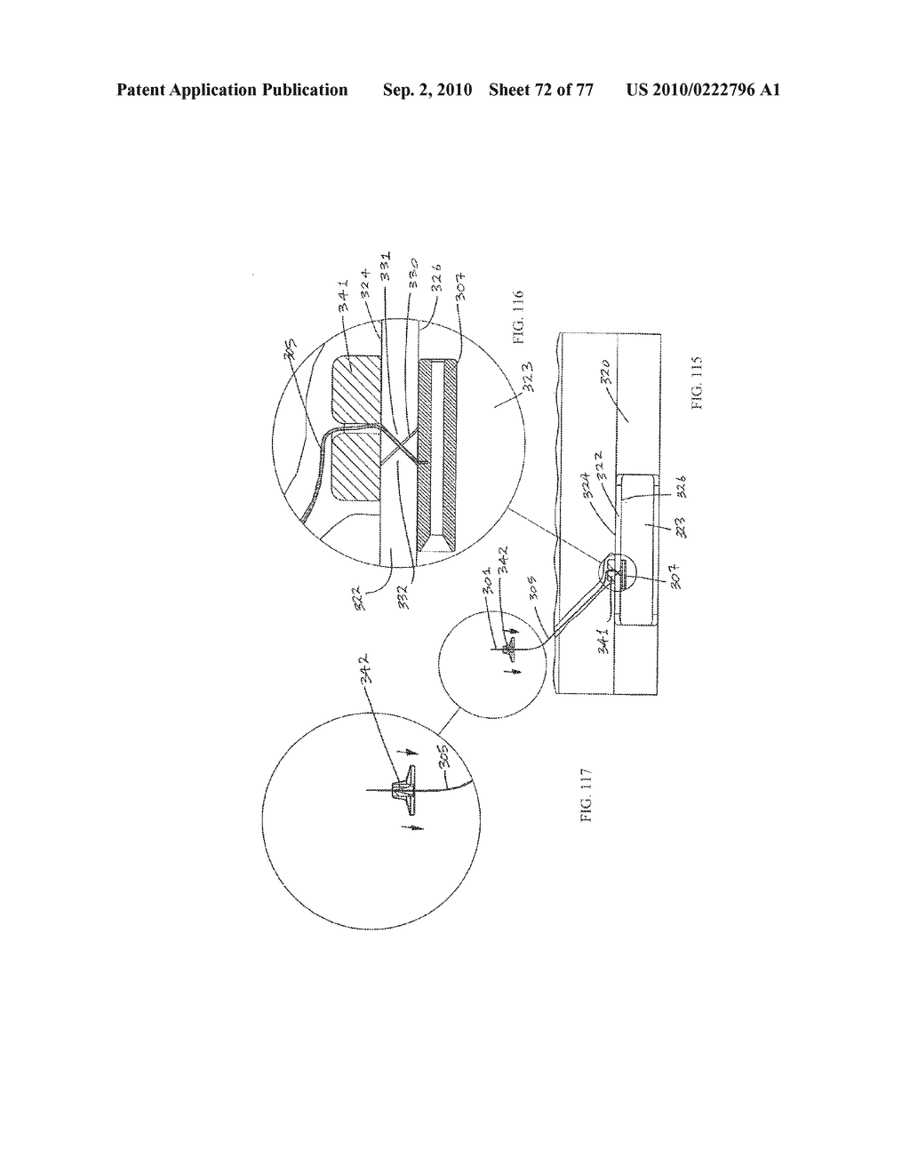 INTERVENTIONAL MEDICAL CLOSURE DEVICE - diagram, schematic, and image 73