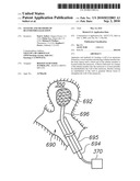 SYSTEMS AND METHODS OF DE-ENDOTHELIALIZATION diagram and image