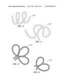 SYSTEMS AND METHODS OF DE-ENDOTHELIALIZATION diagram and image