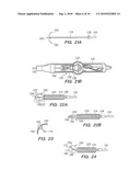 SYSTEMS AND METHODS OF DE-ENDOTHELIALIZATION diagram and image