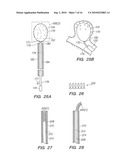 SYSTEMS AND METHODS OF DE-ENDOTHELIALIZATION diagram and image