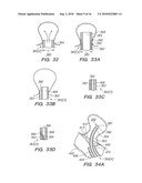 SYSTEMS AND METHODS OF DE-ENDOTHELIALIZATION diagram and image