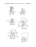 SYSTEMS AND METHODS OF DE-ENDOTHELIALIZATION diagram and image