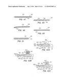 SYSTEMS AND METHODS OF DE-ENDOTHELIALIZATION diagram and image