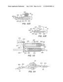 SYSTEMS AND METHODS OF DE-ENDOTHELIALIZATION diagram and image