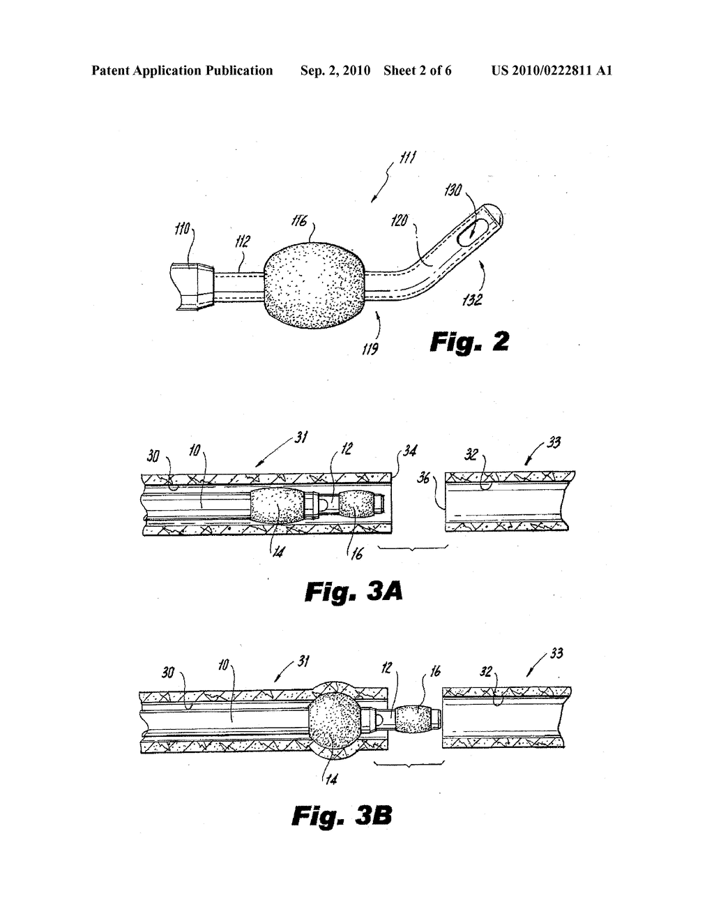 Tissue Approximation Device - diagram, schematic, and image 03