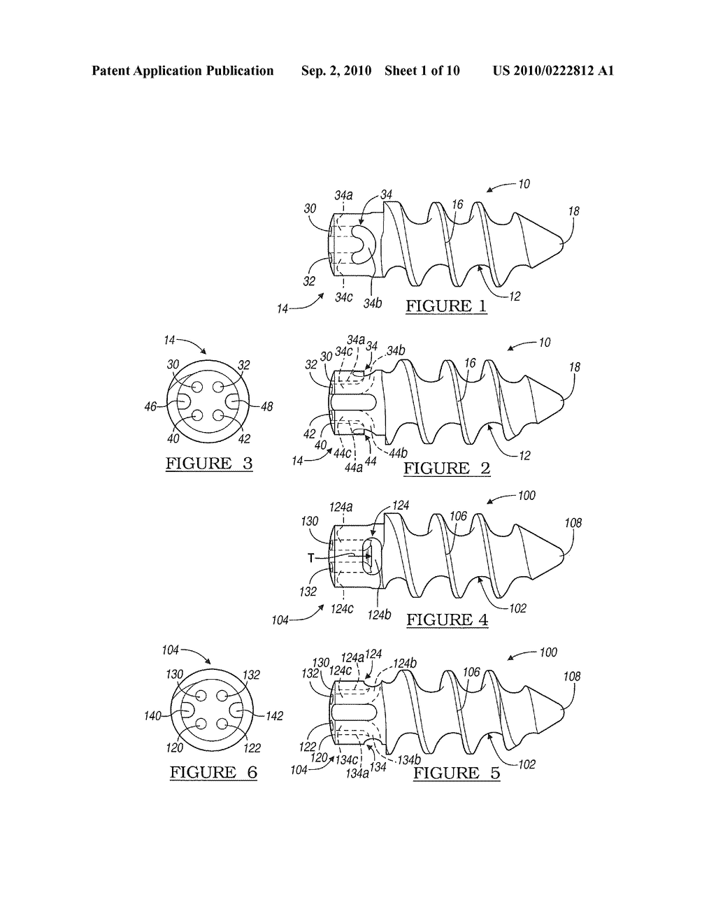 Method and Apparatus for Suture Anchors With a Vertical Eyelet - diagram, schematic, and image 02