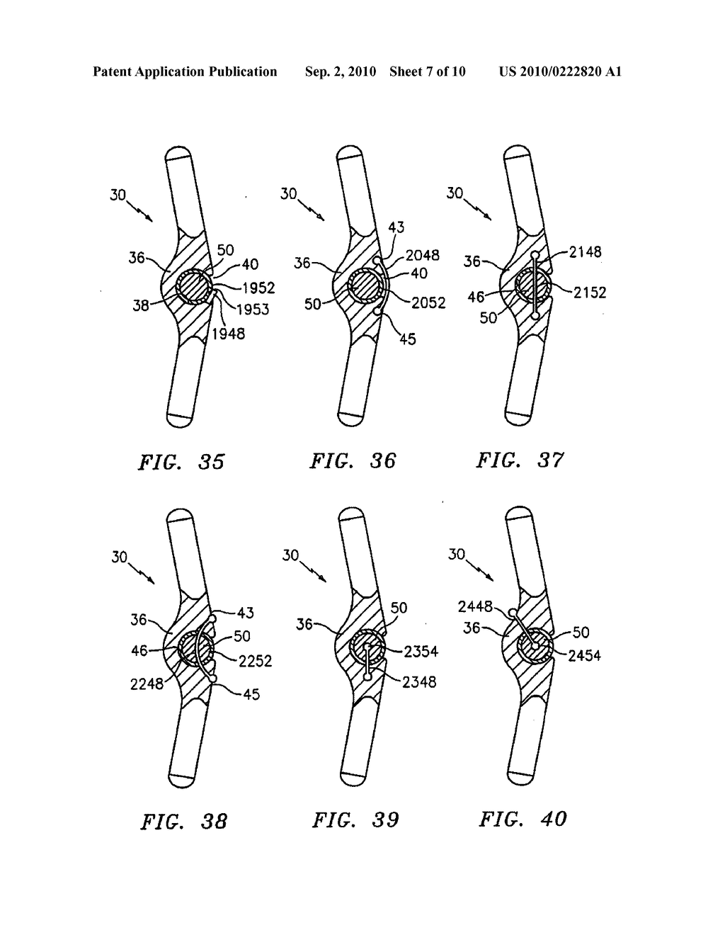 VERTEBRAL ROD SYSTEM AND METHODS OF USE - diagram, schematic, and image 08