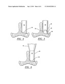 CONFIGURED AND SIZED CANNULA diagram and image