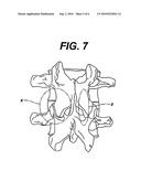 CONFIGURED AND SIZED CANNULA diagram and image