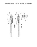 SPINAL FIXATION ELEMENT ROTATION INSTRUMENT diagram and image