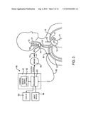 ELECTRODE STRUCTURES AND METHODS FOR THEIR USE IN CARDIOVASCULAR REFLEX CONTROL diagram and image