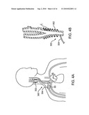 ELECTRODE STRUCTURES AND METHODS FOR THEIR USE IN CARDIOVASCULAR REFLEX CONTROL diagram and image