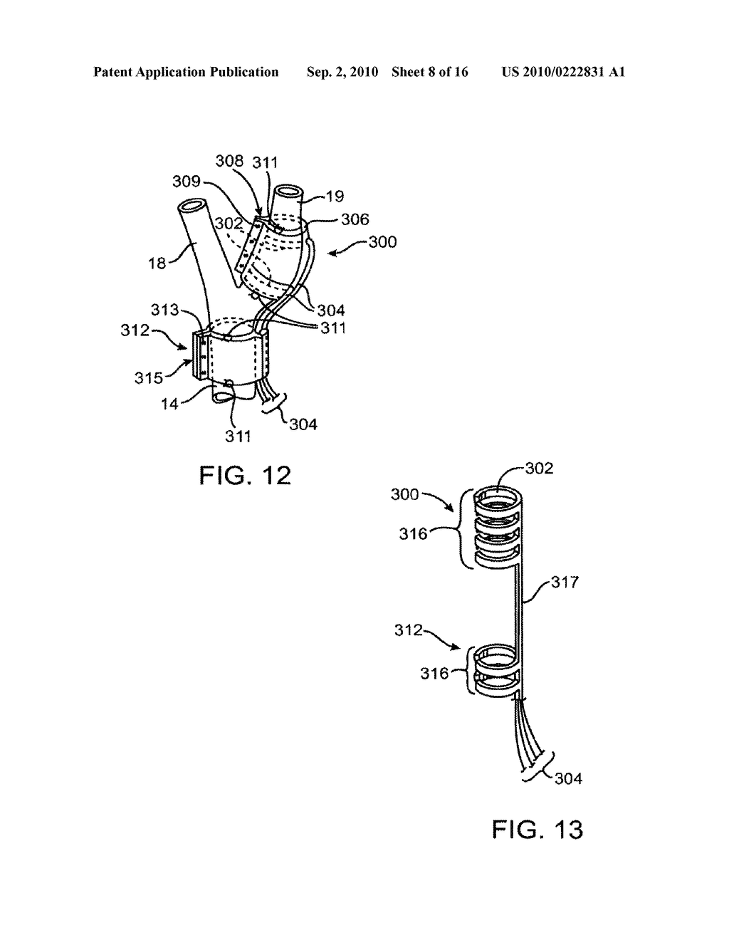 ELECTRODE STRUCTURES AND METHODS FOR THEIR USE IN CARDIOVASCULAR REFLEX CONTROL - diagram, schematic, and image 09