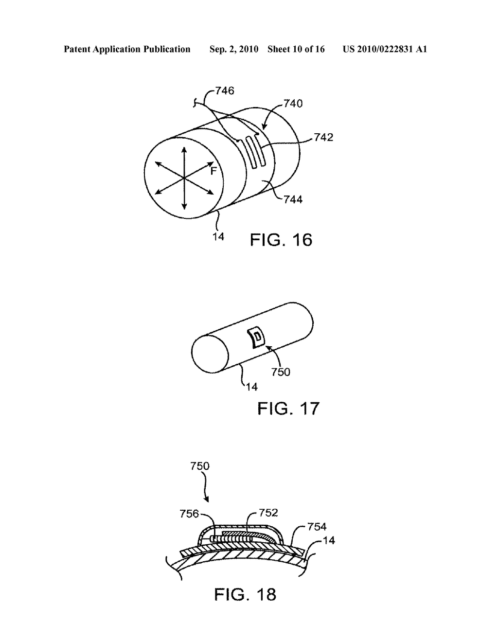 ELECTRODE STRUCTURES AND METHODS FOR THEIR USE IN CARDIOVASCULAR REFLEX CONTROL - diagram, schematic, and image 11