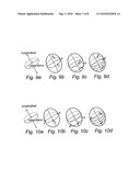 IMPLANTABLE CARDIAC STIMULATOR, DEVICE AND METHOD FOR MONITORING THE HEART CYCLE IN A HUMAN HEART diagram and image