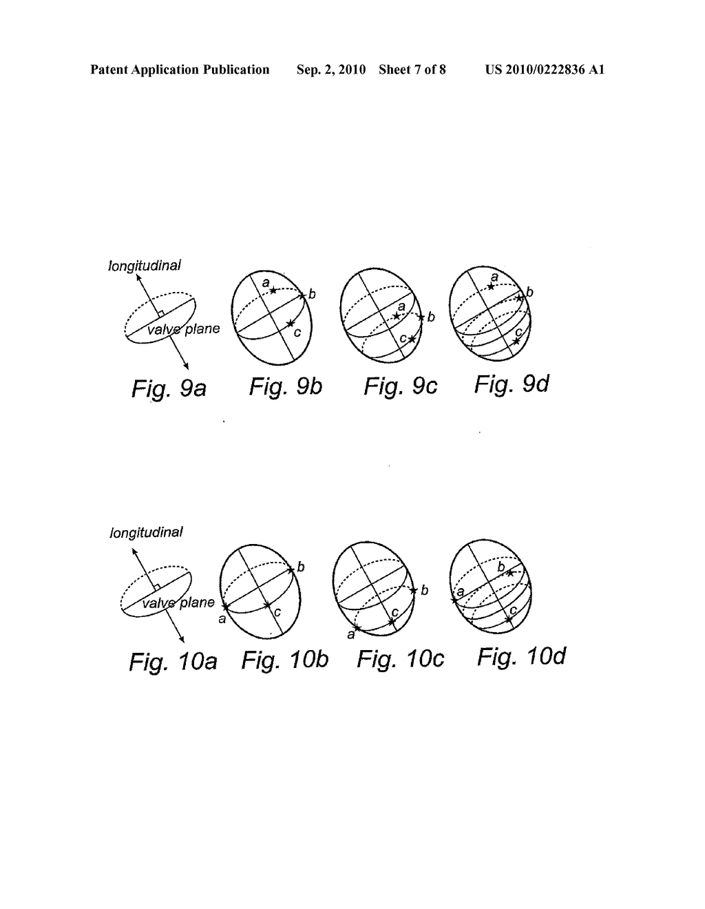 IMPLANTABLE CARDIAC STIMULATOR, DEVICE AND METHOD FOR MONITORING THE HEART CYCLE IN A HUMAN HEART - diagram, schematic, and image 08