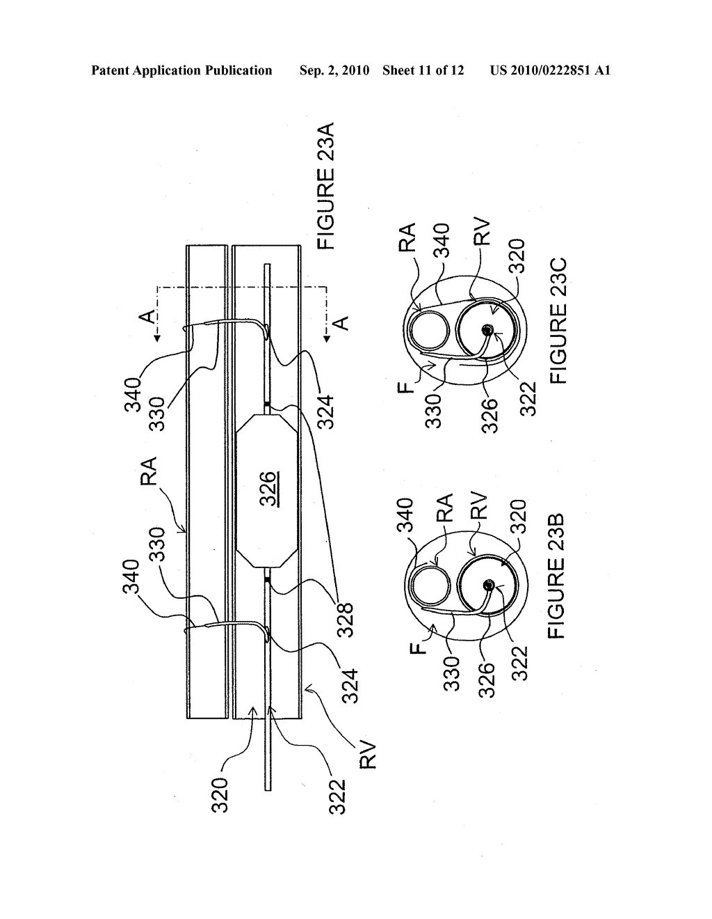 METHODS FOR MONITORING RENAL NEUROMODULATION - diagram, schematic, and image 12