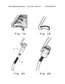 Apparatus and Method for Decolonizing Microbes on the Surfaces of the Skin and In Body Cavities diagram and image