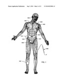 Band stop filter employing a capacitor and an inductor tank circuit to enhance MRI compatibility of active medical devices diagram and image