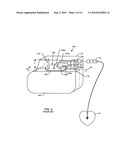 Band stop filter employing a capacitor and an inductor tank circuit to enhance MRI compatibility of active medical devices diagram and image