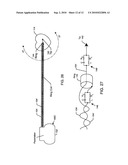 Band stop filter employing a capacitor and an inductor tank circuit to enhance MRI compatibility of active medical devices diagram and image