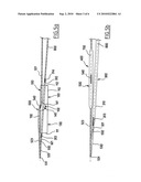 System for Treating Lesions on a Blood Vessel Bifurcation diagram and image