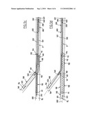 System for Treating Lesions on a Blood Vessel Bifurcation diagram and image