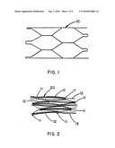 Intraluminal Stent Graft diagram and image