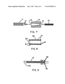 Intraluminal Stent Graft diagram and image