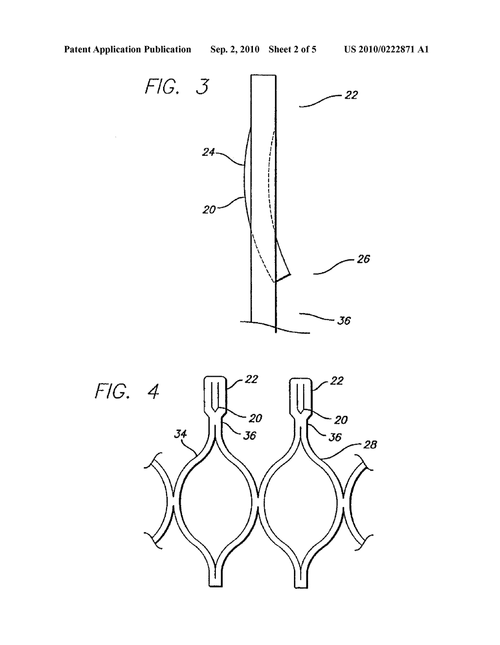 MECHANISM FOR SECURING TO A CORPOREAL LUMEN AND METHOD OF MANUFACTURING - diagram, schematic, and image 03