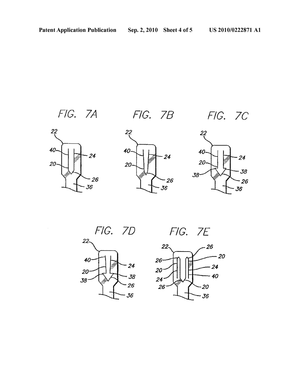 MECHANISM FOR SECURING TO A CORPOREAL LUMEN AND METHOD OF MANUFACTURING - diagram, schematic, and image 05