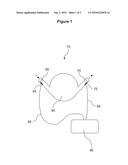 BLOOD PUMP SYSTEM WITH ARTERIAL PRESSURE MONITORING diagram and image