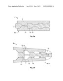 FIXATION DEVICE AND METHOD diagram and image