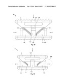 FIXATION DEVICE AND METHOD diagram and image