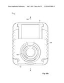 FIXATION DEVICE AND METHOD diagram and image