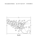 FIXATION DEVICE AND METHOD diagram and image