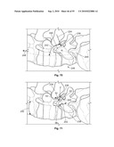 FIXATION DEVICE AND METHOD diagram and image