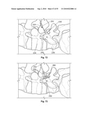 FIXATION DEVICE AND METHOD diagram and image