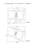 FIXATION DEVICE AND METHOD diagram and image