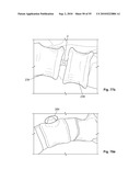 FIXATION DEVICE AND METHOD diagram and image