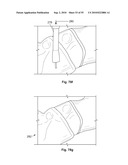 FIXATION DEVICE AND METHOD diagram and image